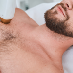 Peluria in eccesso: come combattere l’ipertricosi